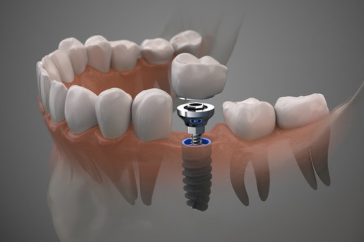 Paruchuri Super Speciality Dental Hospital