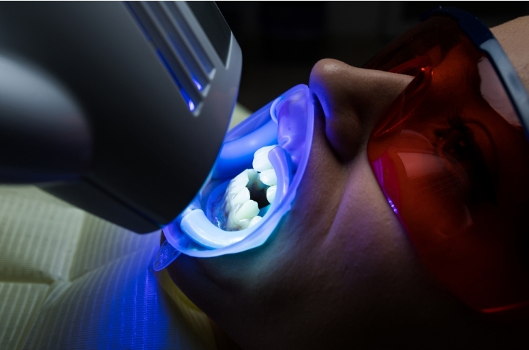 Laser Dentistry image