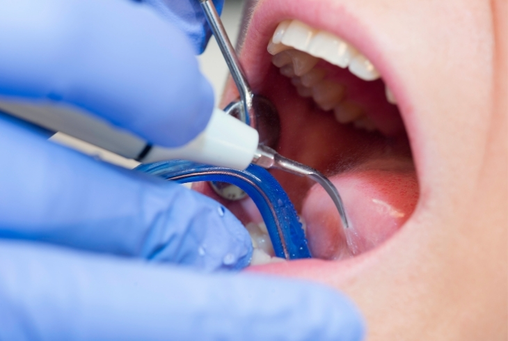 Paruchuri Super Speciality Dental Hospital