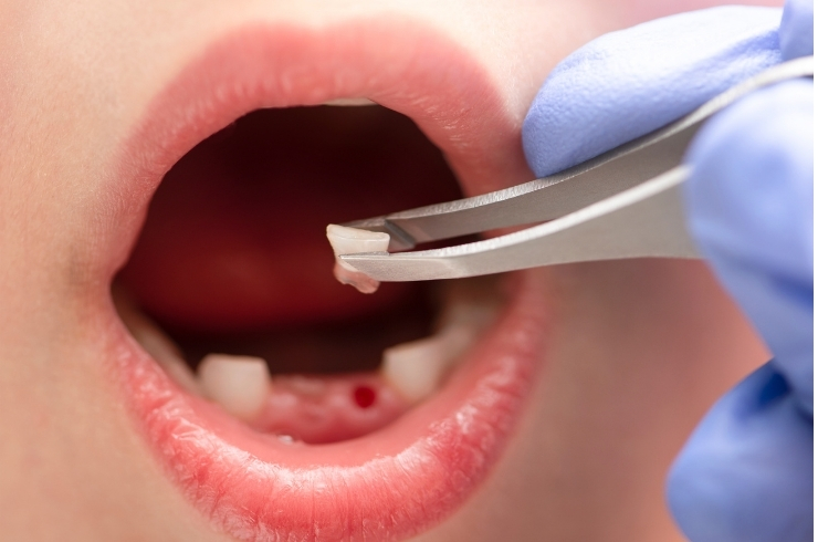 Paruchuri Super Speciality Dental Hospital